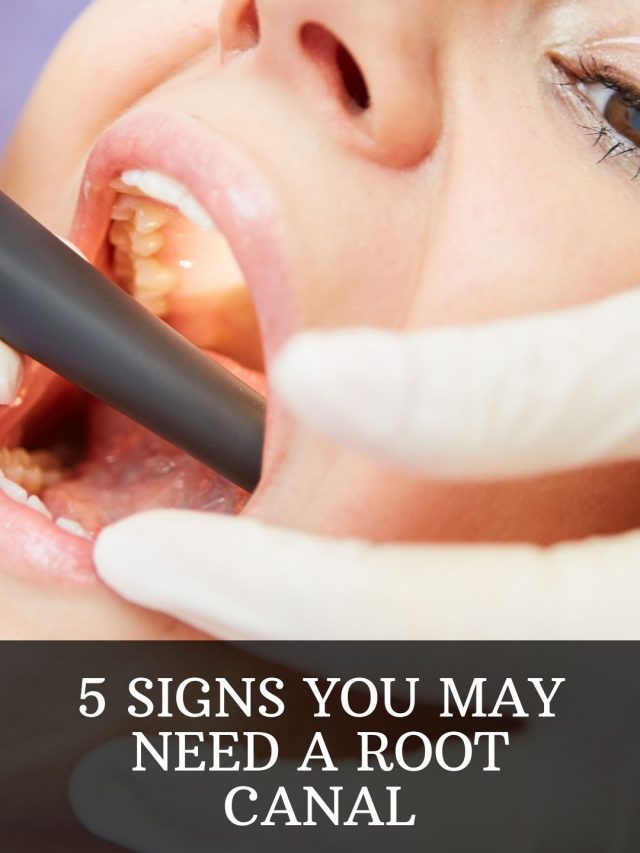 Signs you need root canal