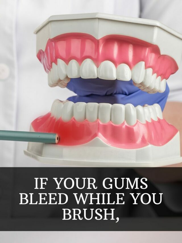Gum bleeding while brushing
